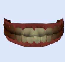 teeth after polygon reduction